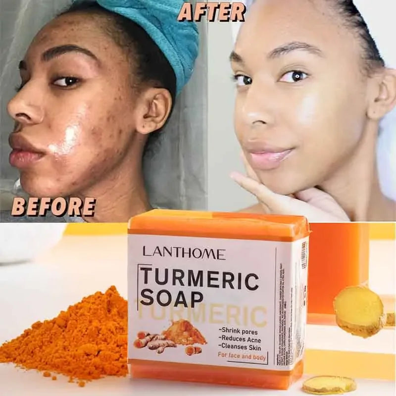 Golden Glow Turmeric Soap Face Cleansing Anti Acn