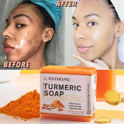 Golden Glow Turmeric Soap Face Cleansing Anti Acn